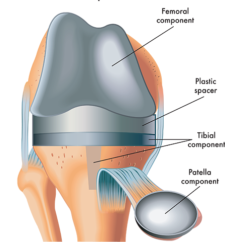 knee diploma course online